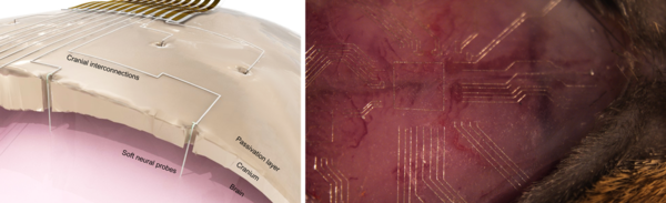 기초과학연구원 나노의학 연구단 천진우 단장 연구팀이 개발한 뇌-컴퓨터 인터페이스(BCI) 형성 기술. (왼쪽 사진)뇌에 삽입되는 액체금속 기반의 부드러운 신경전극과 두개골 표면을 따라 얇게 형성되는 전자회로 이미지. (오른쪽 사진) 두개골 곡면을 따라 형성된 생체통합적 통신 전자회로 이미지. /기초과학연구원